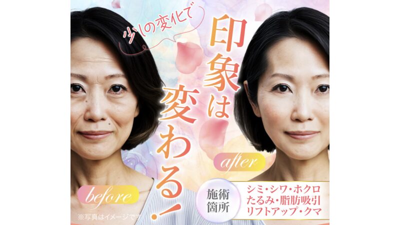 TCB東京中央美容外科